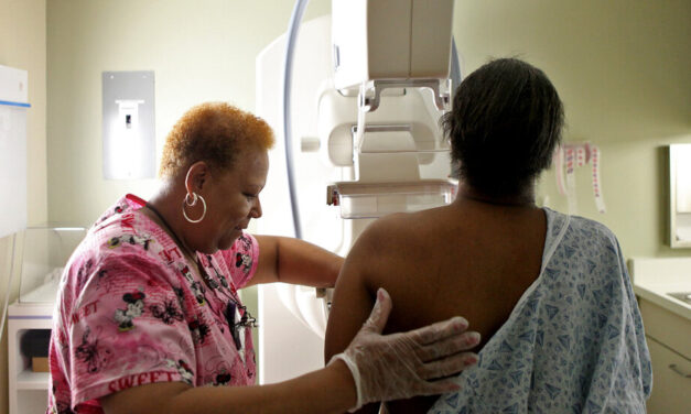 The FDA requires disclosure of dense breasts in mammography clinics