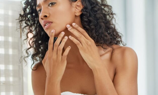How to get rid of a pimple fast: 10 Holy Grail solutions