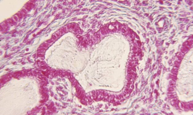 Part of the technology is said to be worth $1 trillion.  But taboos hold it back