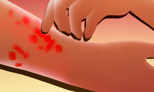 Her Strange Blisters Wouldn’t Go Away. What Was It?