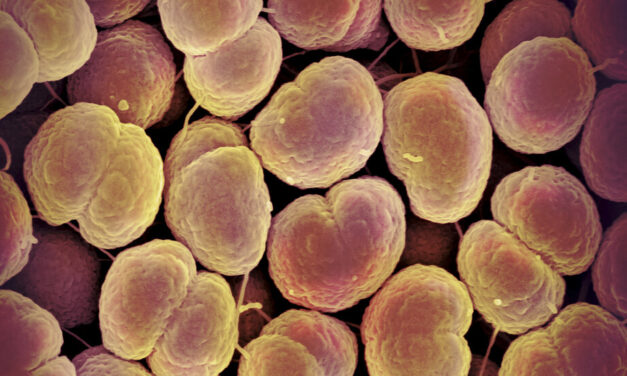 Gonorrhea Is Becoming Drug Resistant. Scientists Just Found a Solution.