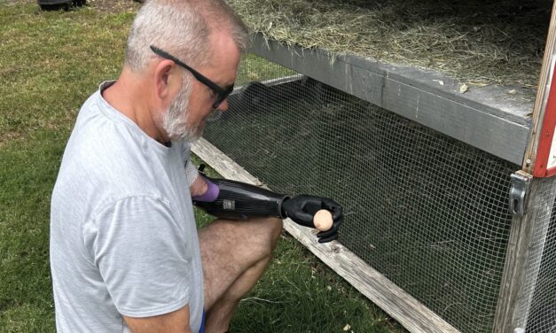 Aether Biomedical, bionic hand startup, gets $5.8 million to scale