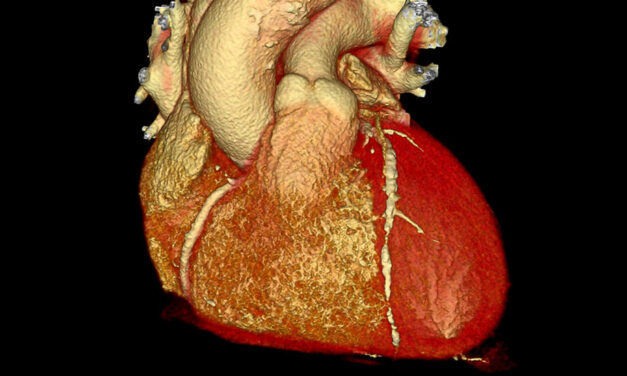 New Gene Editing Treatment Cuts Dangerous Cholesterol in Small Study