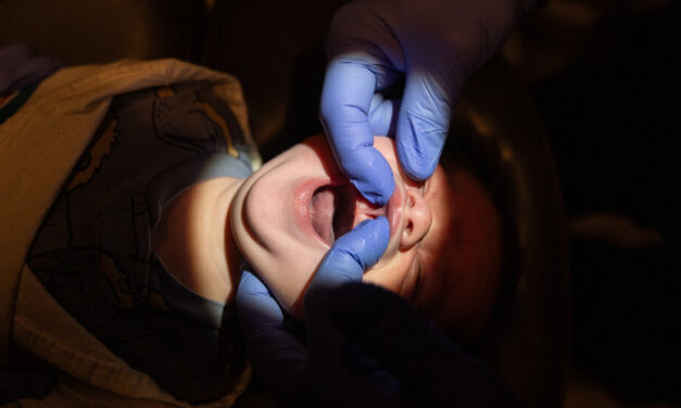 How Tongue Tie and Lip Tie Surgery Became a Big Business