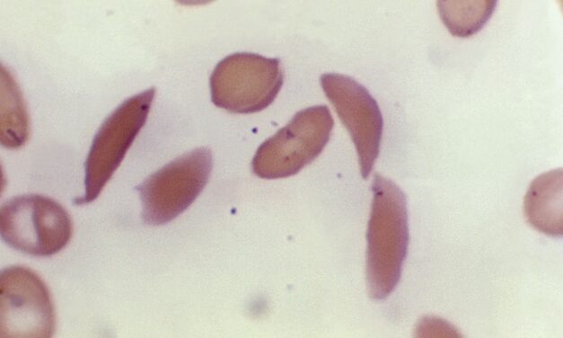 First CRISPR gene-editing treatment approved in U.S.