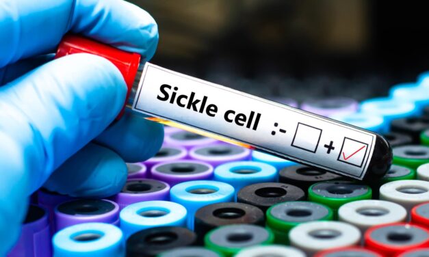 Sickle cell disease gene therapies Casgevy Lyfgenia insurance cost issues