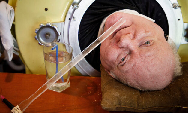 Paul Alexander, Polio Survivor Who Lived in Iron Lung for 70 Years, Dies age 78