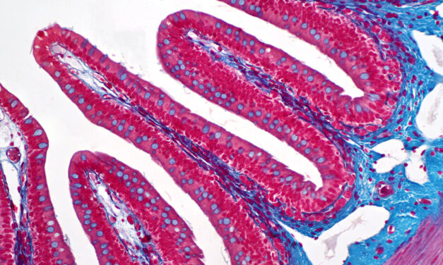 Younger Adults Are Missing Early Warning Signs of Colon Cancer