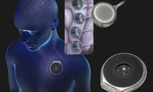 Paradromics gears up to test its brain implant on humans