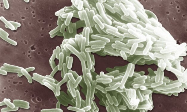 Listeria Outbreak Tied to Deli-Sliced Meat Kills at Least 2, CDC Says