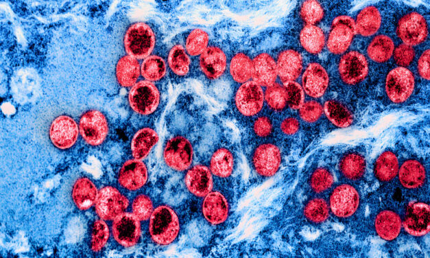 Why the latest mpox outbreak is raising alarm among health experts