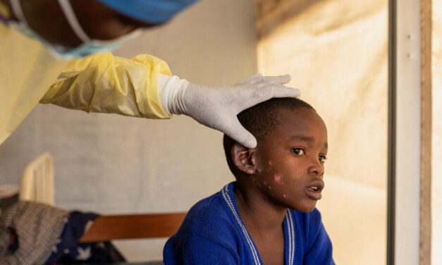 How Did Mpox Become a Global Emergency? What’s Next?