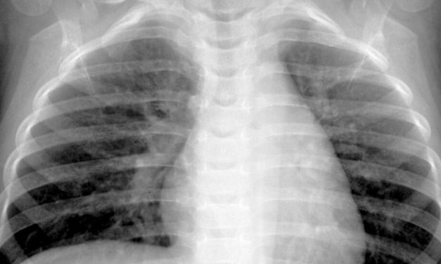 What we know about HMPV, the virus spreading in China