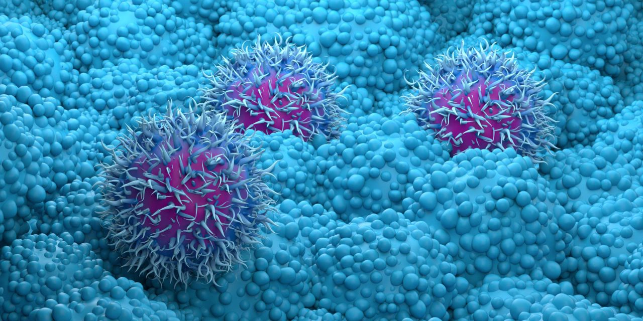 Revolution Medicines’ pancreatic cancer drug daraxonrasib was successful in the study