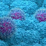 Revolution Medicines’ pancreatic cancer drug daraxonrasib was successful in the study